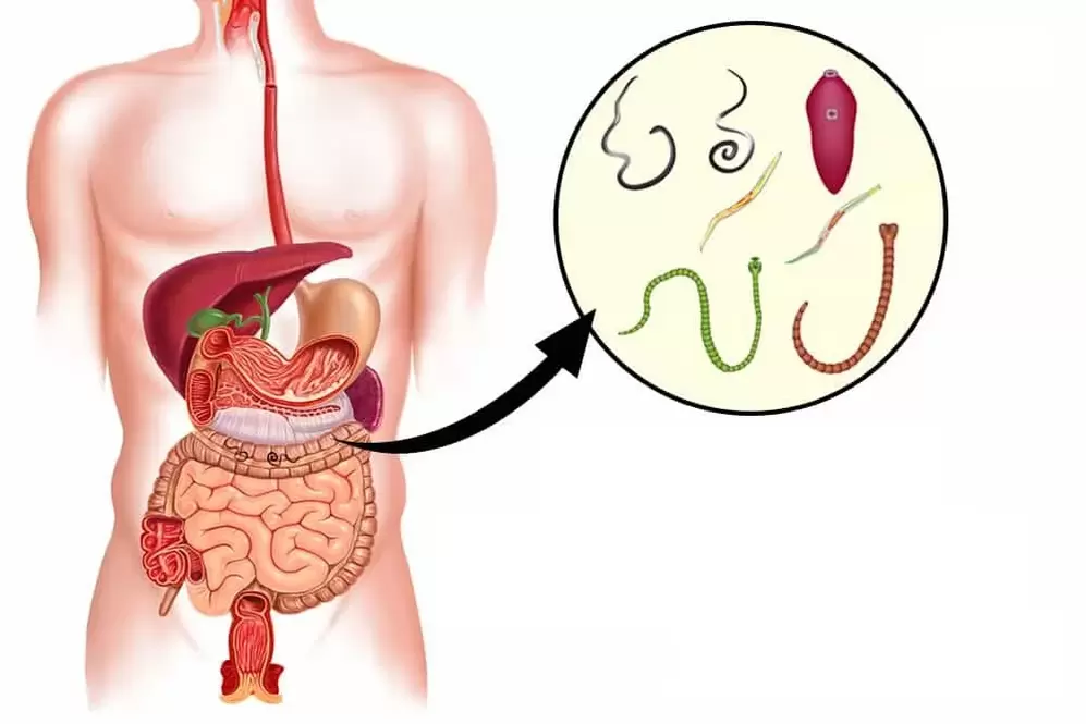 worms are parasites in the human intestine