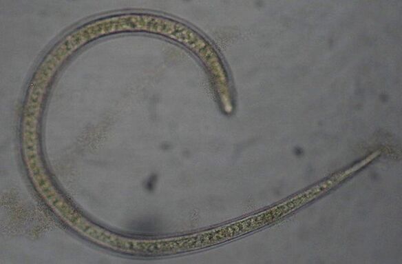Trichinella is a round protostome parasitic worm