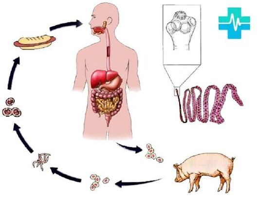 Infection ways