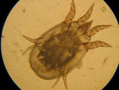 Check under a microscope